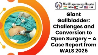 Giant Gallbladder: Surgical Challenges and Transition to Open Surgery