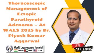 Join WALS 2025 and Unlock Free Indemnity Insurance Worth ₹10 Lakh!