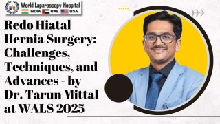Redo Hiatal Hernia Surgery with Advanced Techniques – Dr. Tarun Mittal at WALS 2025