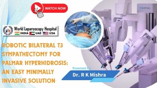 Robotic Bilateral T3 Sympathectomy: A Simple, Minimally Invasive Solution for Palmar Hyperhidrosis