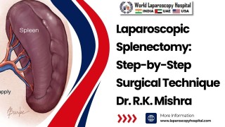 Laparoscopic Splenectomy: Step-by-Step Surgical Technique by Dr R K Mishra