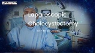 Skin to Skin Laparoscopic Cholecystectomy in 4K