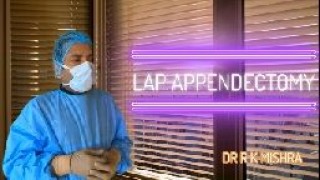 Laparoscopic Appendectomy for Acute Appendicitis in Pediatric Patient