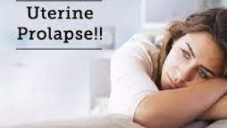 Laparoscopic Hysterectomy with Sacrocolpopexy for Uterine Prolapse in Elderly Women