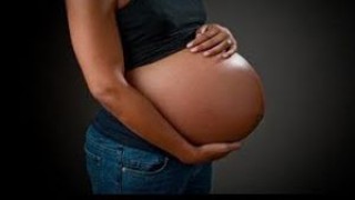 Laparoscopic Removal of Huge Ovarian Cyst