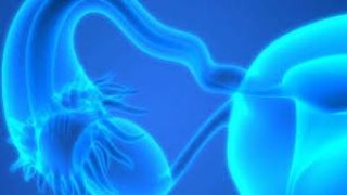 TLH with Bilateral Salpingectomy - Salpingectomy With Hysterectomy May Reduce Cancer Risk