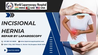 Laparoscopic Repair of Incisional Hernia