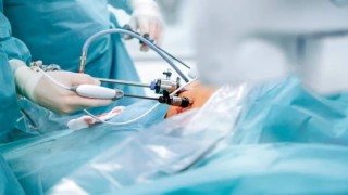 Surgery of Laparoscopic Omentalbiopsy