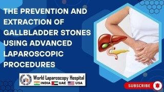 Prevention & Extraction of Gallstones with Advanced Laparoscopy