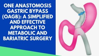 One Anastomosis Gastric Bypass (OAGB)