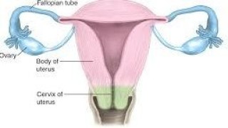 Laparoscopic Tubal Recanalization Surgery