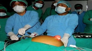 Video on the pros and cons of laparoscopic ventral and incisional hernia repair