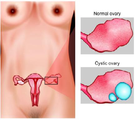 Anatomy of ovary