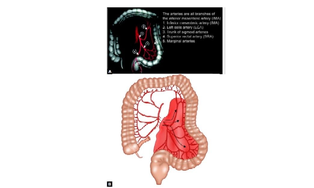 Arterial supply of sigmoid colon