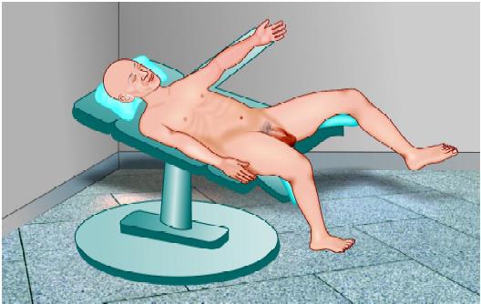 Patient position for laparoscopic choledochotomy