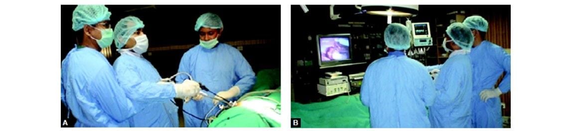 Single incision laparoscopic surgery