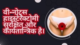 वी-नोट्स हाइस्टेरेक्टोमी सुरक्षित और कार्यतान्त्रिक है।