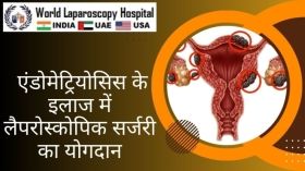 एंडोमेट्रियोसिस के इलाज में लेप्रोस्कोपिक सर्जरी का योगदान 