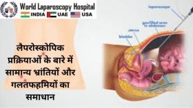 लैप्रोस्कोपिक प्रक्रियाओं के बारे में सामान्य भ्रांतियों और गलतफहमियों का समाधान 