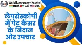  लैपरोस्कोपी में पेट कैंसर के निदान और उपचार