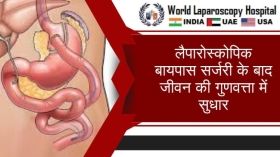 लैपारोस्कोपिक बायपास सर्जरी के बाद जीवन की गुणवत्ता में सुधार