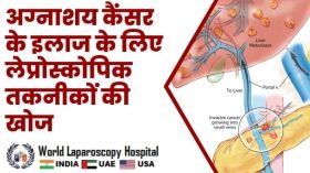अग्नाशय कैंसर के इलाज के लिए लेप्रोस्कोपिक तकनीकों की खोज