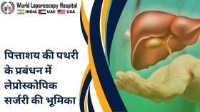 पित्ताशय की पथरी के प्रबंधन में लेप्रोस्कोपिक सर्जरी की भूमिका