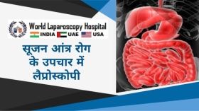सूजन आंत्र रोग के उपचार में लैप्रोस्कोपी