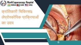 क्रांतिकारी चिकित्सा: लेप्रोस्कोपिक प्रक्रियाओं का उदय