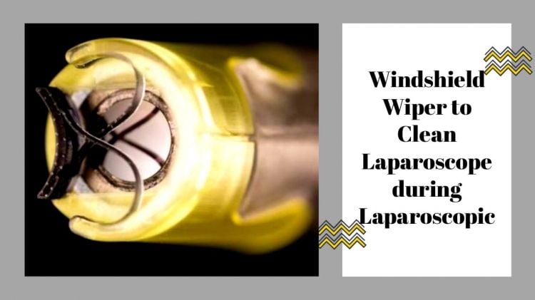 Windshield Wiper to Clean Laparoscope during Laparoscopic Surgery