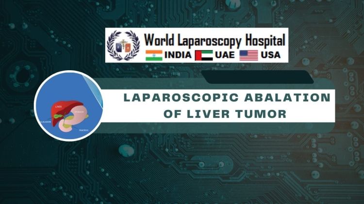 Laparoscopic ablation of hepatic tumors