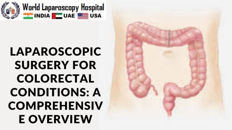 Laparoscopic Surgery for Colorectal Conditions: A Comprehensive Overview