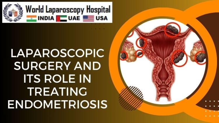 Laparoscopic Surgery and its Role in Treating Endometriosis
