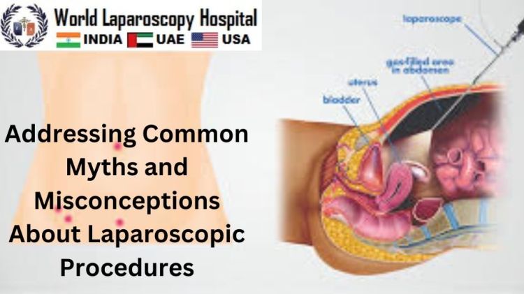 Addressing Common Myths and Misconceptions About Laparoscopic Procedures