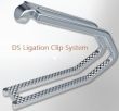 Laparoscopic Ligation System Delivers Savings and Security during Appendectomy