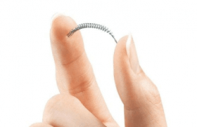 Essure contraceptive Controversy 