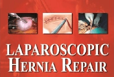 Acceptance of Laparoscopic Hernia Surgery is tripled from year 2001