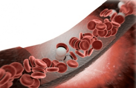 The Immunologic Effects of Surgery: Spurring Tumor Growth