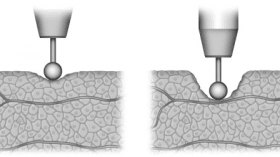 Minimally Invasive Electro-coagulation to Rejuvenate the Vaginal Anatomy