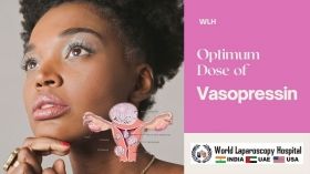 Optimal Dose of Vasopressin in Laparoscopic Myomectomy for Fibroid Uterus