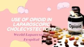 Effect of preoperative use of opioid in laparoscopic cholecystectomy
