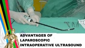 Advantages of laparoscopic intraoperative ultrasound
