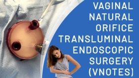 Benefits of vaginal natural orifice transluminal endoscopic surgery (vNOTES) Technique