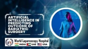 Artificial Intelligence in Predicting Outcome of Bariatric Surgery