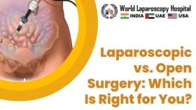 Laparoscopy vs. Open Surgery: Which Is the Better Option?