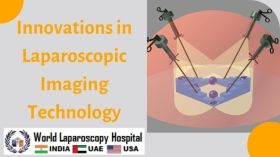 Innovations in Laparoscopic Imaging Technology