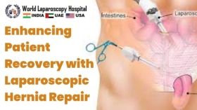 Enhancing Patient Recovery with Laparoscopic Hernia Repair