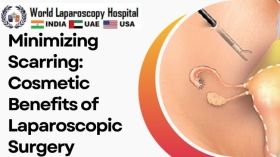 Minimizing Scarring: Cosmetic Benefits of Laparoscopic Surgery