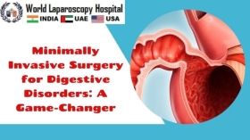 Minimally Invasive Surgery for Digestive Disorders: A Game-Changer