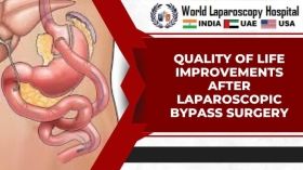 Quality of Life Improvements After Laparoscopic Bypass Surgery
